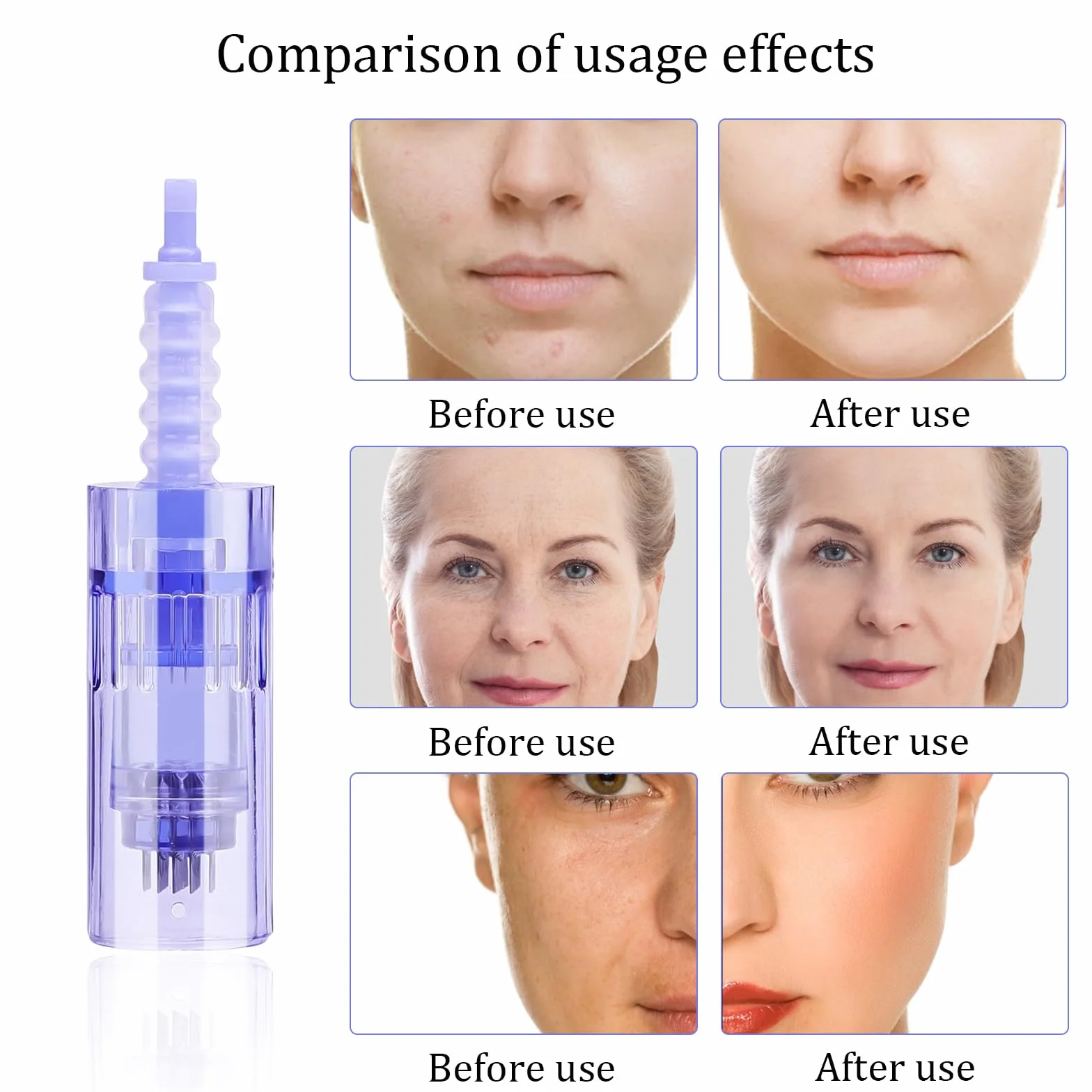 30 Pezzi Aghi Di Ricambio 36pin Dermapen Microneedling Confezionata Singolarmente Micro Aghi Dermapen Per Auto Electric Deep Microaghi Derma Pen Adatta alla Baionetta Penna Micro-ago
