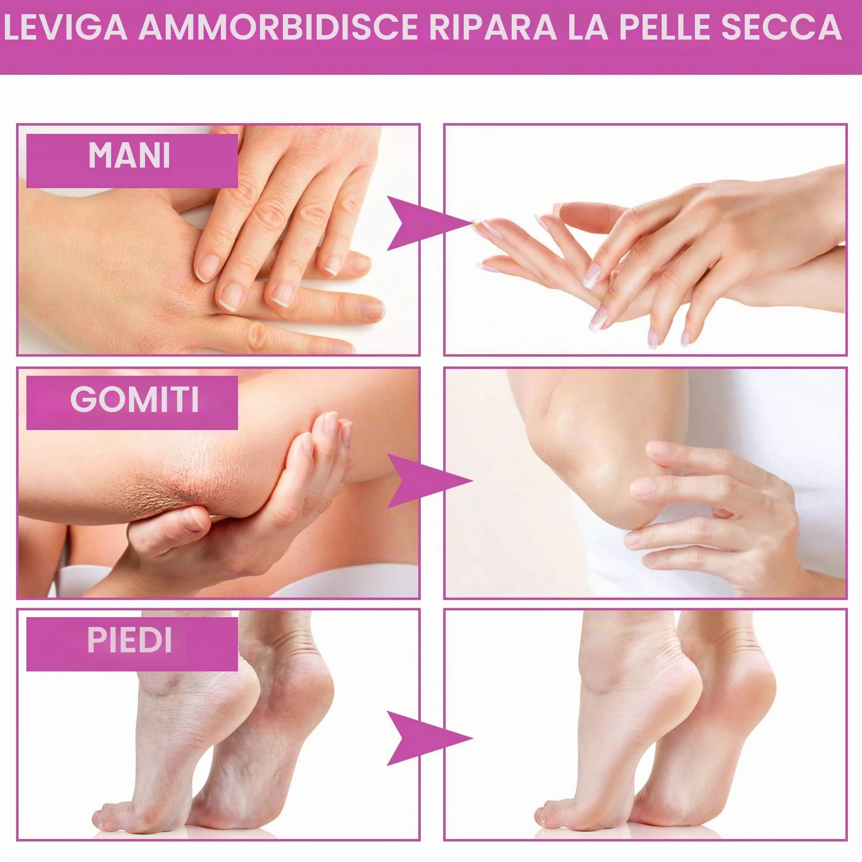 Dispositivo per Bagno di Paraffina per mani e Piedi, con Accessori, Vasca per Cera Elettrica, con Cera di Paraffina 265W