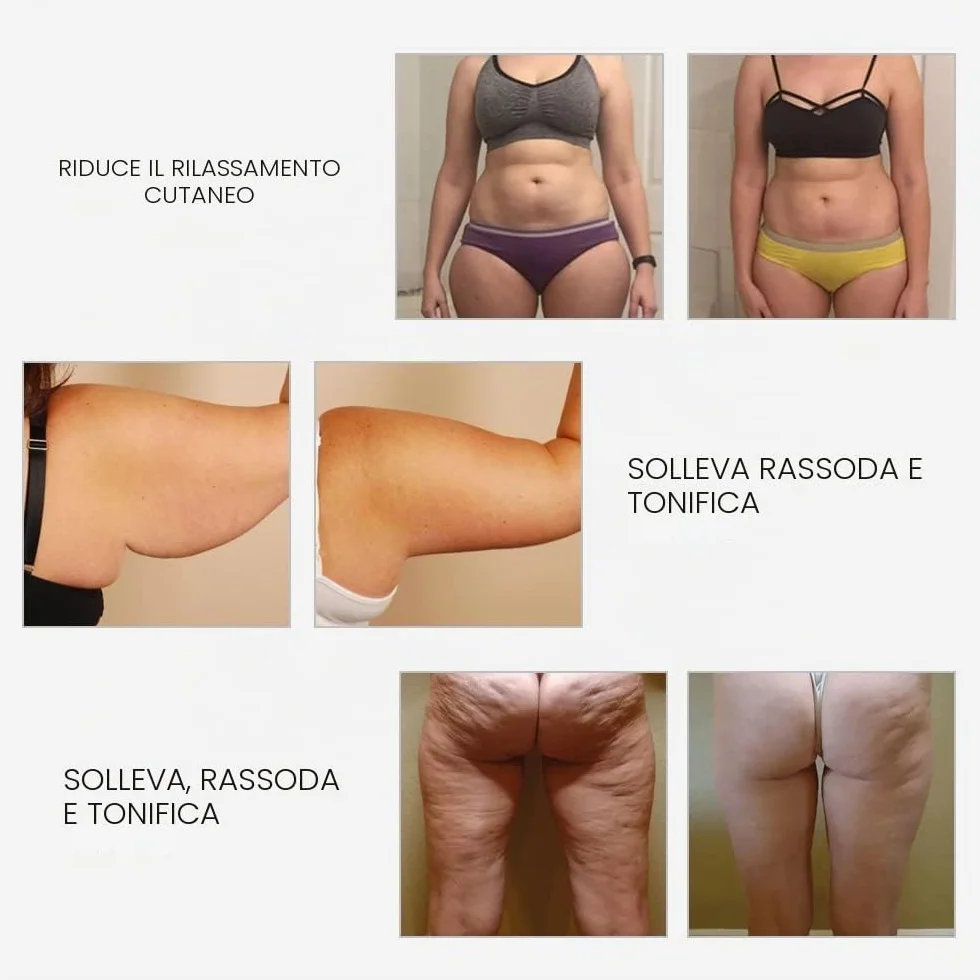 RF Radiofrequenza viso e corpo macchina rassodante – Professionale Home RF Lifting Skin Care Anti Aging Device – Effetti salone / più sicuro (bianco)