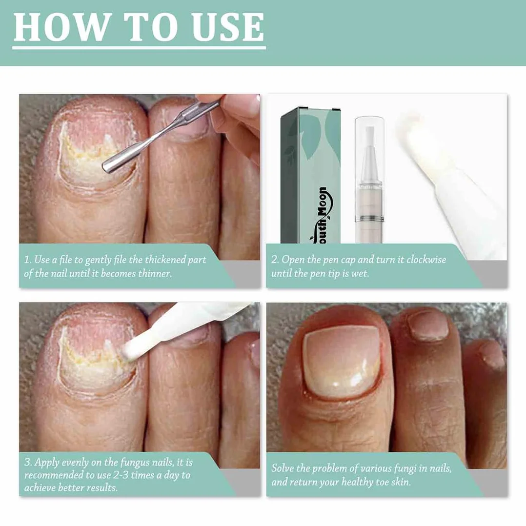 3 pezzi Penna per la Cura Delle Unghie, nail care pen fungo del chiodo, Pennas per Cuticole Unghie Nail Treatment Pen Con Aloe Vera e Olio Dell'albero,Per Cura Delle Unghie e Delle Cuticole