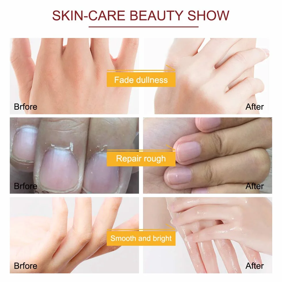 Maschera Per Le Mani Guanti, 5 Paia Maschera Idratanti Per Mani Esfoliante al Miele con Estratti Vegetali Naturali, Collagene, Sbiancanti e Antietà, Riparazione Della Pelle Ruvida (Miele e latte)