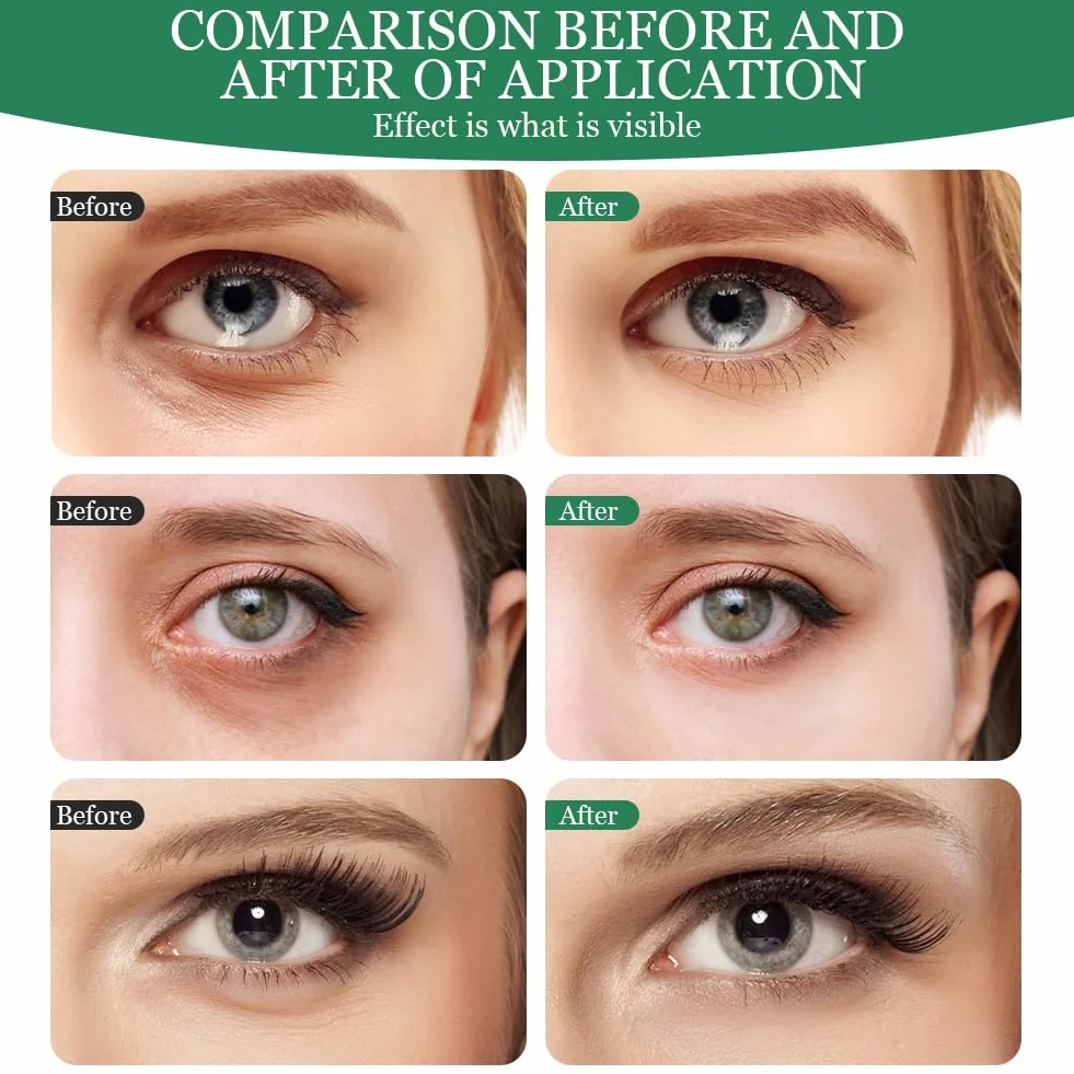 LOPHE Patch Occhi, 60 Pezzi Eye Patch Maschera Occhiaie e Borse, Collagene Patches Occhi per Rimuovi Puffiness, Idrata Anti-Età(Verde)