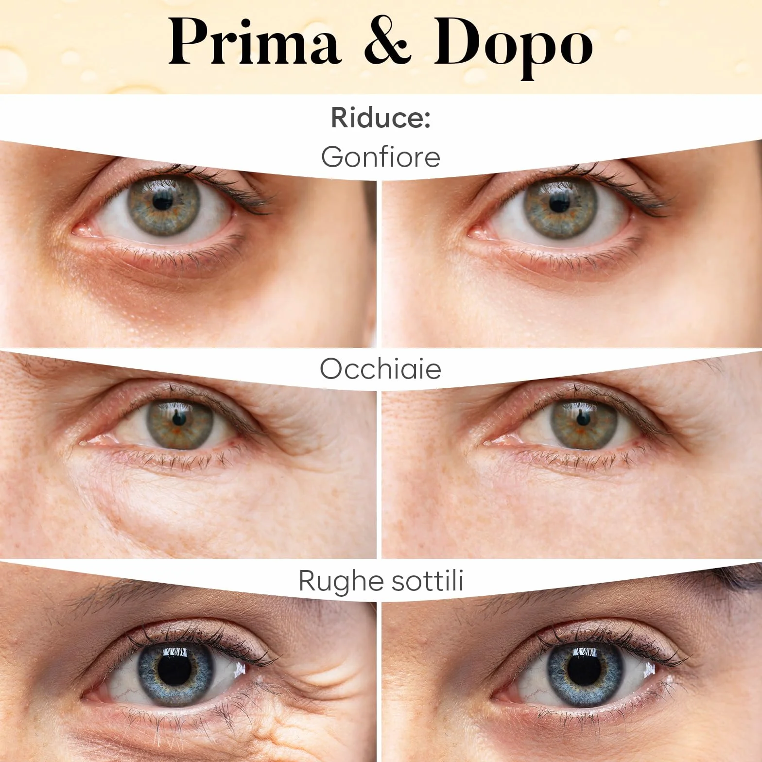 AURAE Patch Occhi, Maschera Occhi con Vitamin C e Caffeina, Patch Occhiaie e Borse, Maschera Occhiaie, Eye Mask per Schiarente e l'idratazione (30 paia)
