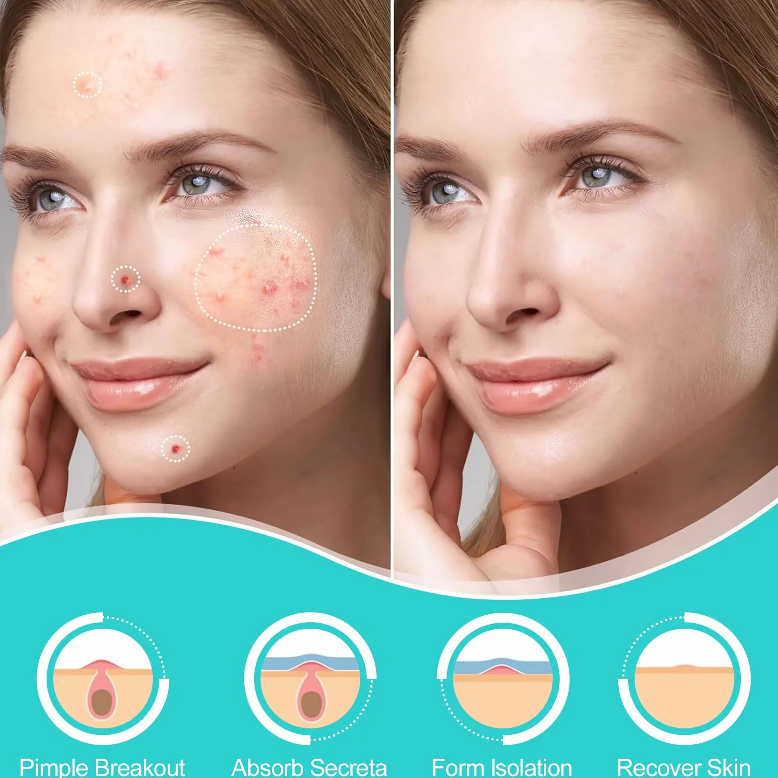 Cerotti per Brufoli 306 Pezzi con Olio dell'Albero del Tè e Acido Salicilico - Patch Brufoli Acne Invisibili, Impermeabili e Traspiranti per Giorno e Notte, Rimuovono Velocemente i Brufoli e l'Acne