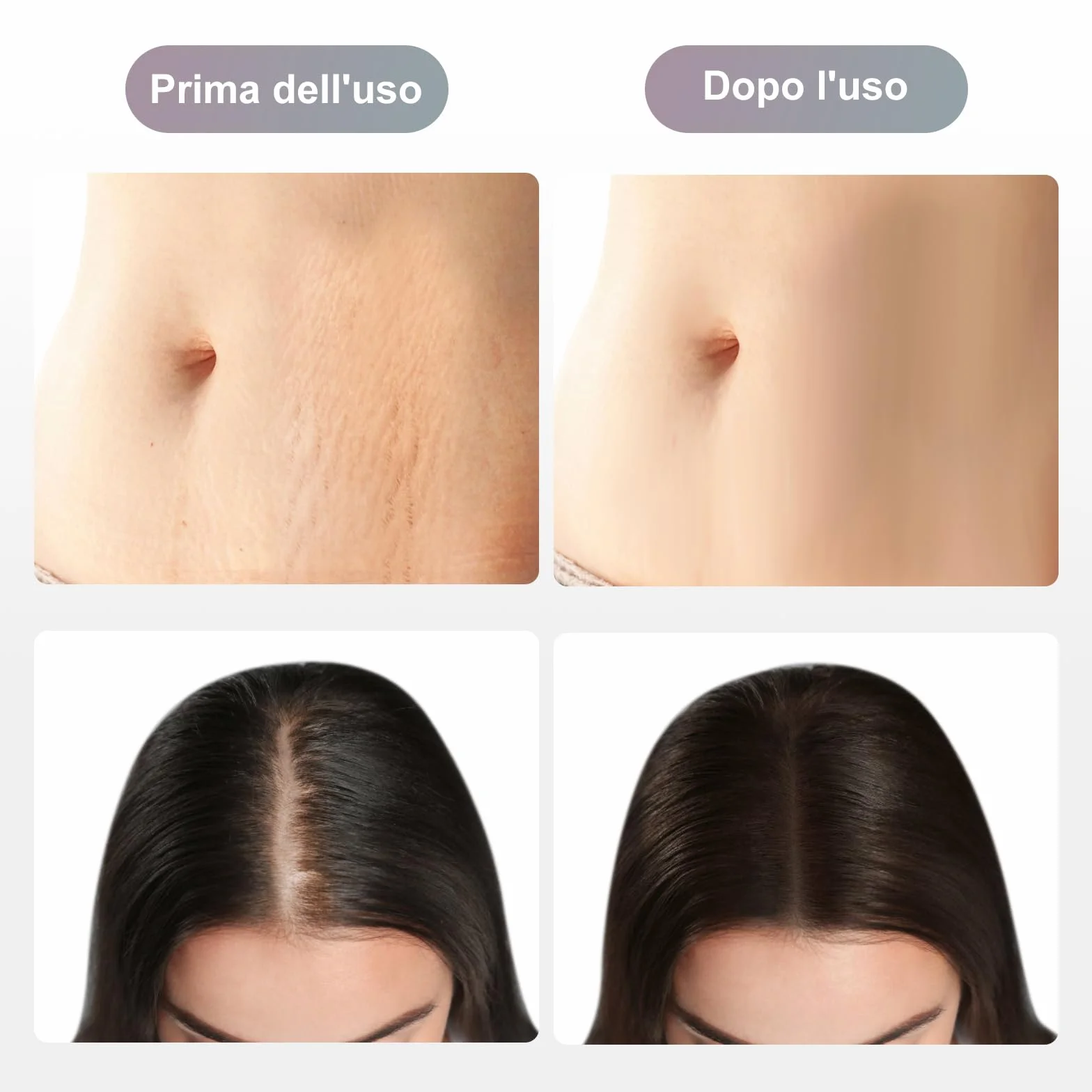 Dr.pen M8 Cartucce 36 Pins - Confezione da 10 Aghi di ricambio usa e getta originali per penna Microneedling - per Dr. penna Ultima M8 Microneedling Electric Derma Pen (aghi da 36 pin, 10 pezzi)