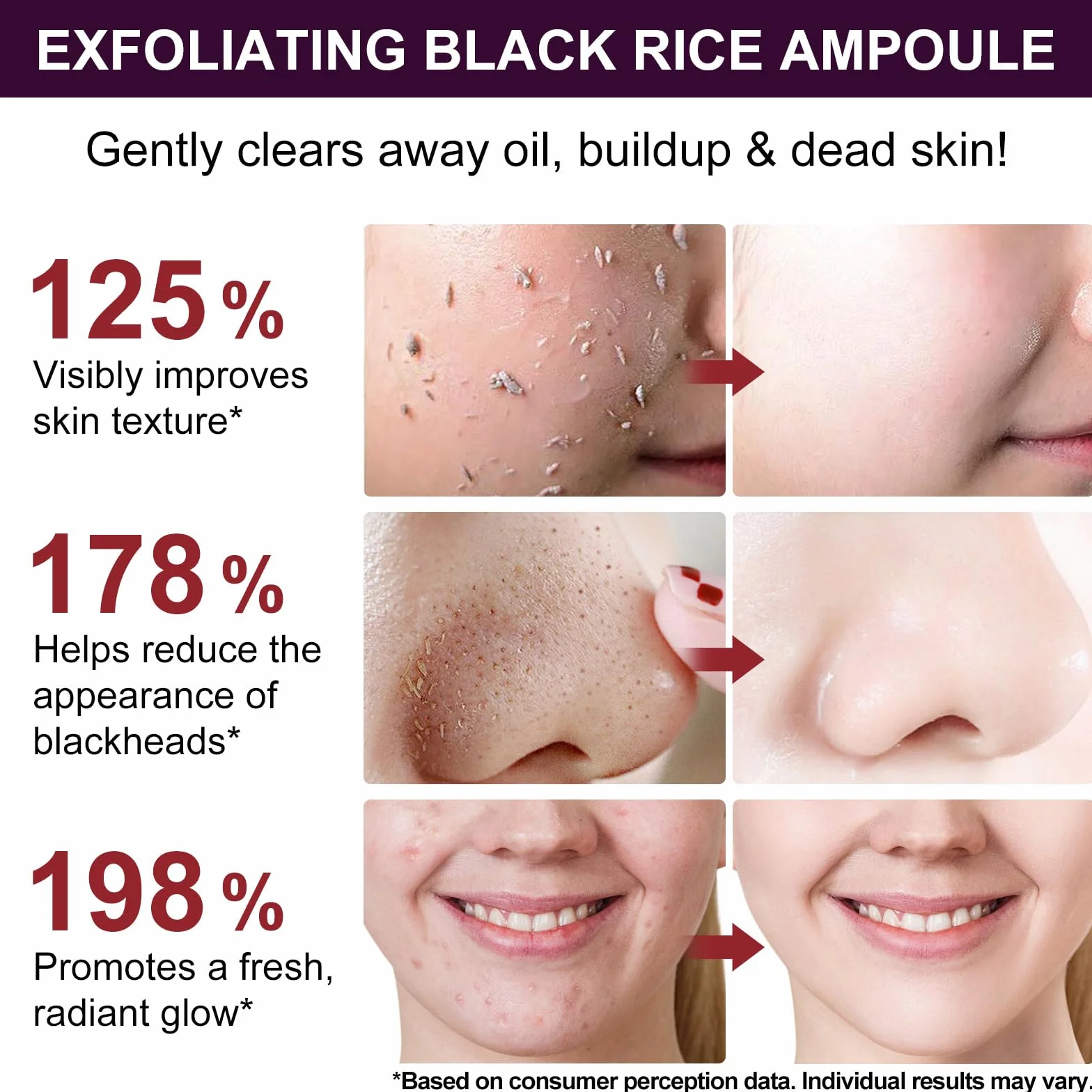 Black Rice Peeling Serum 100ml, Esfoliante Viso Delicato, Siero Esfoliante Riso Nero, Rimuove Cellule Morte e Punti Neri, Minimizza Pori, Niacinamide & Estratto di Riso Nero, Pelle Luminosa e Liscia