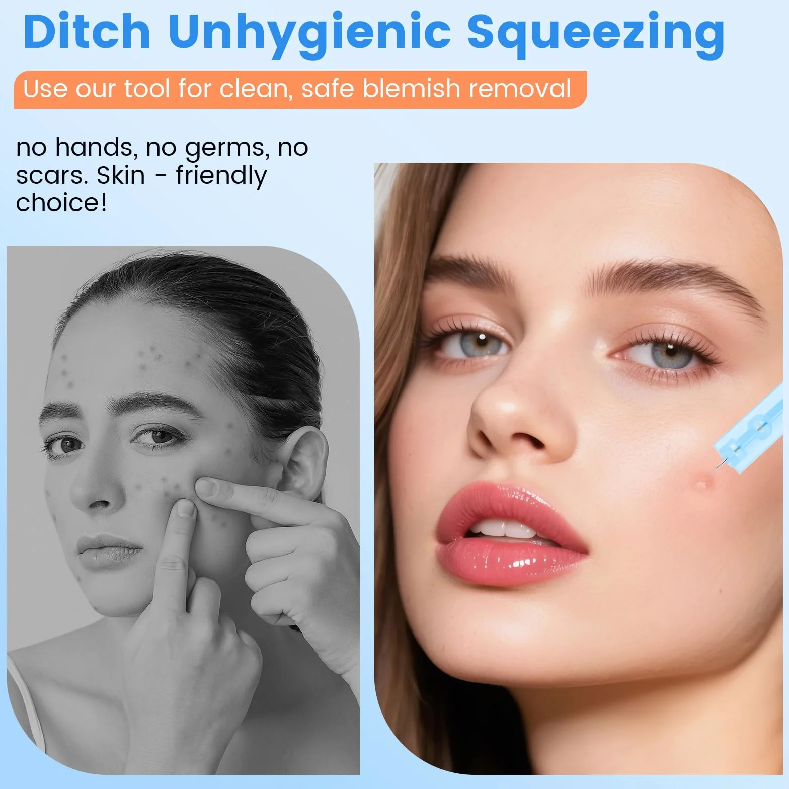 Confezione da 100 aghi monouso per acne brufoli, per difetti facciali, salone di bellezza a casa