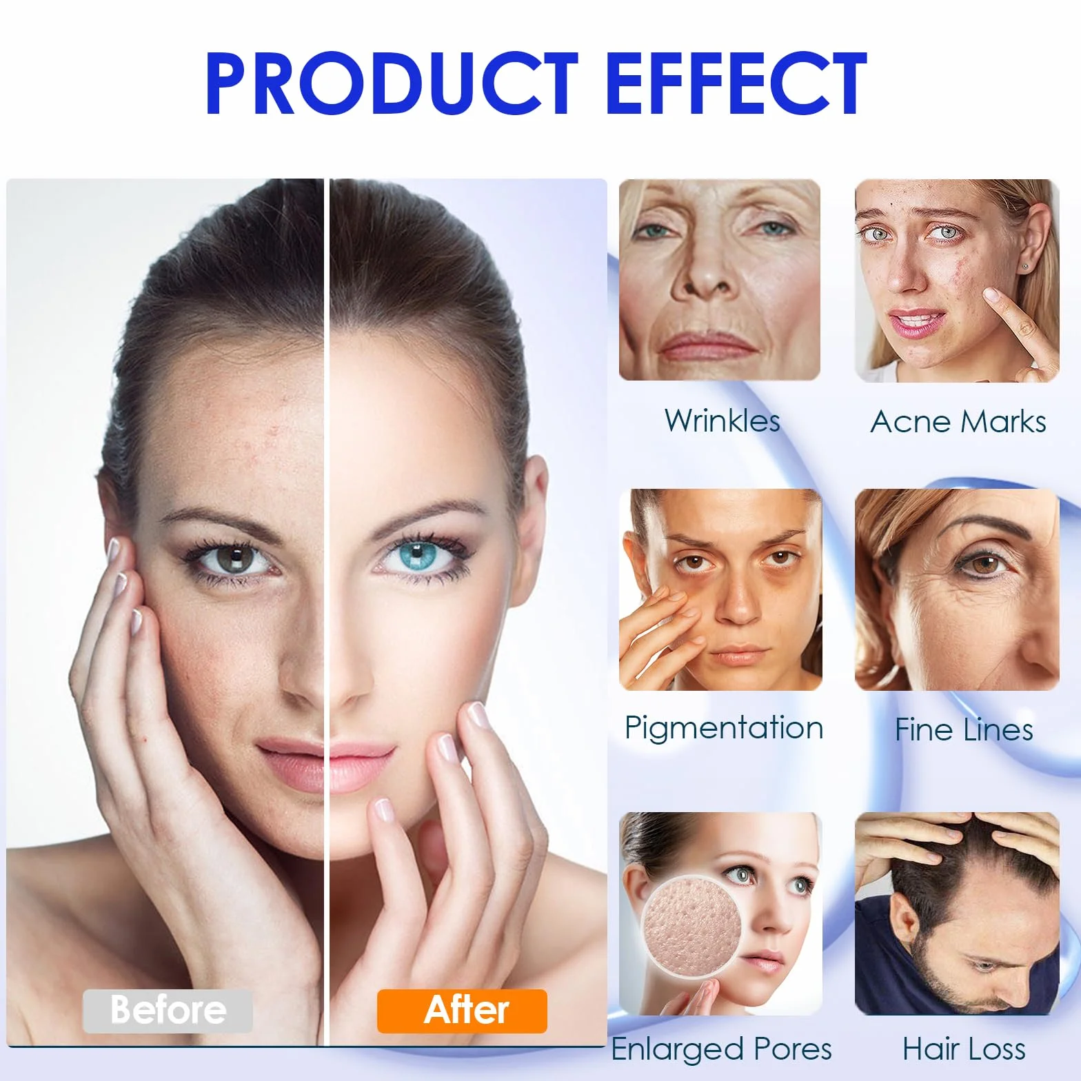 Aghi di Ricambio Dr.pen Ultima A6, Cartucce di Aghi a 42 Pin per Penna per Microneedling Dr.pen Modello A6, Cartucce Monouso Autentiche per Microneedling (42 Pin, 30 Pz)
