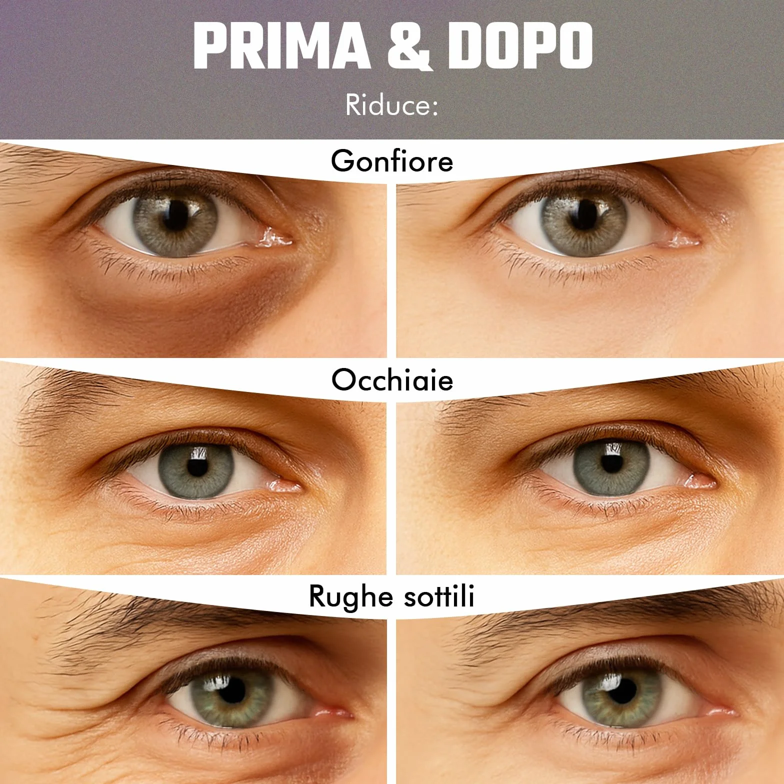 Patch Occhi al Bakuchiol (20 paia), Maschera Occhi con Caffeina, Niacinamide e Acido Ialuronico, Patch Occhiaie e Borse, Maschera Occhiaie, Eye Mask per Schiarente e l'idratazione