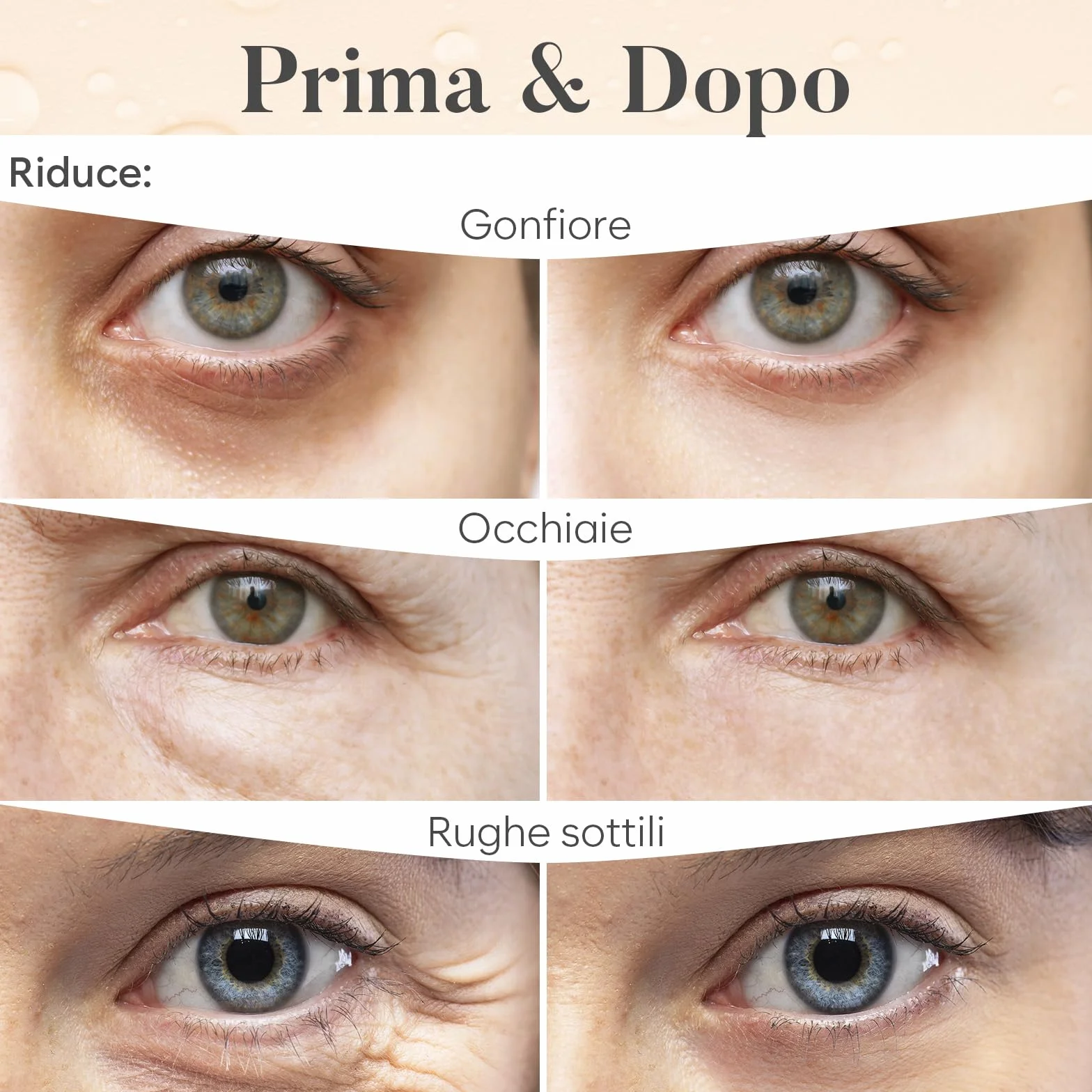 AURAE Patch Occhi (30 paia, mix varietà) – Patch Occhiaie e Borse con Niacinamide + Acido Ialuronico, Effetto Rinfrescante, Idratazione Intensa, Ideali Mattina/Notte
