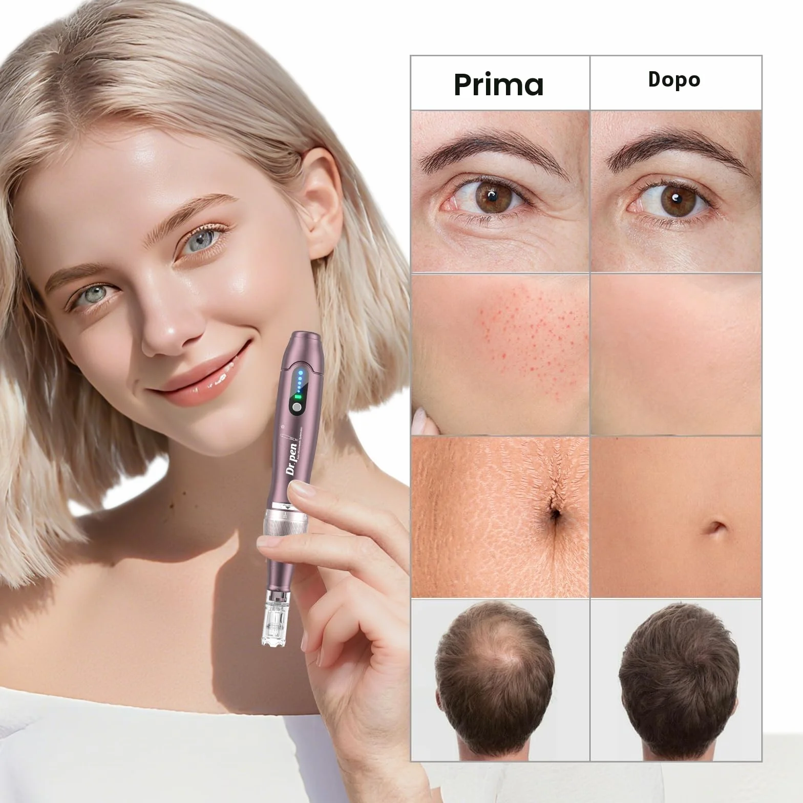 A10 Dermapen Microneedling Professionale, Dr. Pen Microneedling Regolabile Wireless con 25 Cartucce, 5 Livelli e Display LED, Dermapen per Viso, Crescita Capelli e Skincare, per la Casa e in Viaggio