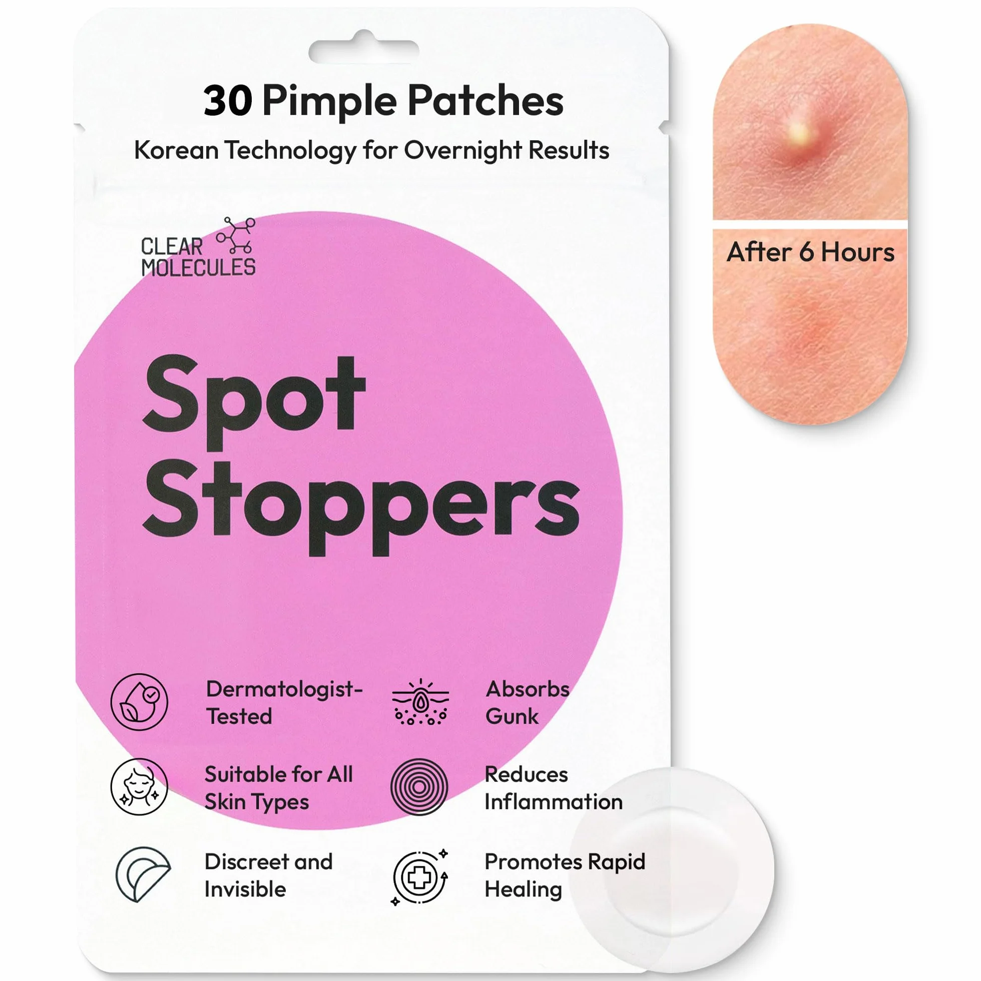 Spot Stoppers - Patch per brufoli idrocolloide, anti-acne, copertura invisibile per spot, patch per acne, 30 pezzi