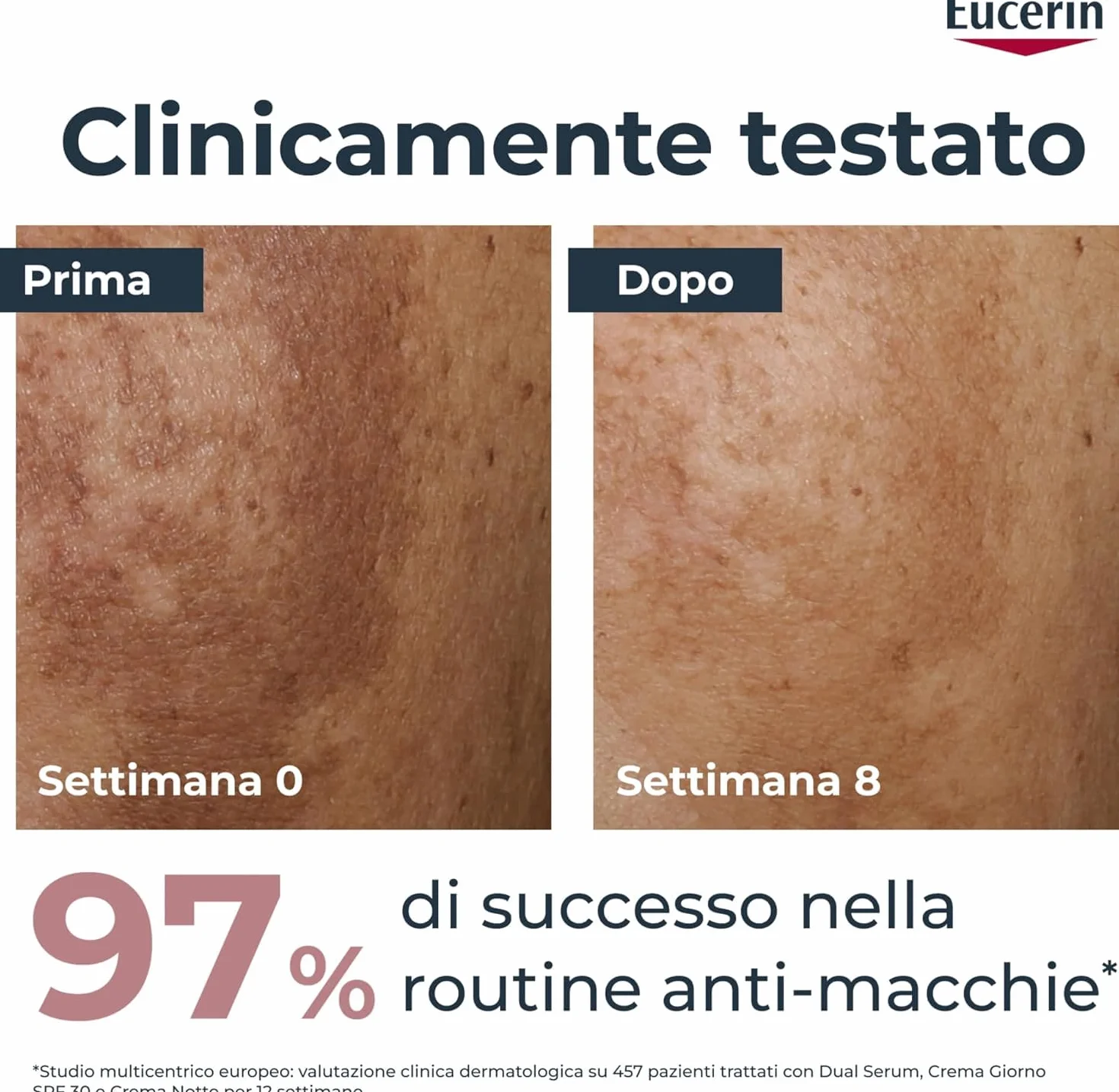Eucerin Skincare Kit Anti-Pigment Routine Anti-Macchie, Cofanetto regalo donna beauty antimacchie con Siero Viso Dual Serum 30 ml, Crema Giorno SPF30 50 ml e Mini Gel Detergente Viso 200 ml