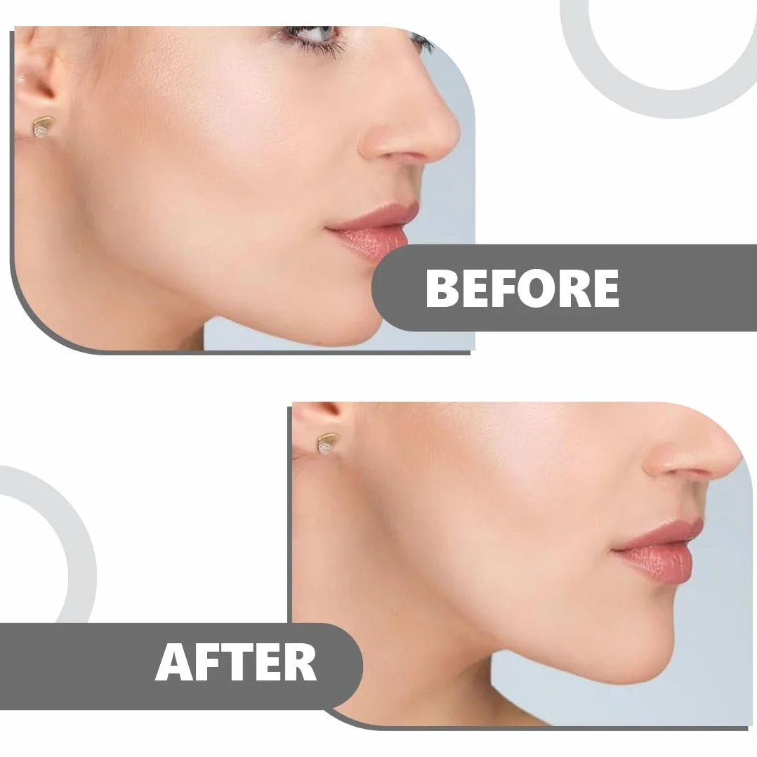 Exerciser Set di 4 Mascella Allenatore Esercizi, Jaw Liner Trainer, Silicone Jaw Exerciser per Uomini e Donne, Jawline Trainer Dispositivo di Rinforzo del Collo Collo Viso Strumento di Masticazione