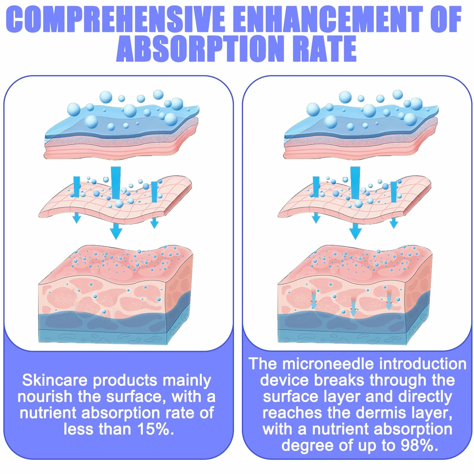 Vaileal 30 pezzi Microneedling: 12 pin Aghi di ricambio Derma Pen Micronago, Micro Electric Dermapen per la rimozione del dispositivo di acne, cicatrici e pieghe