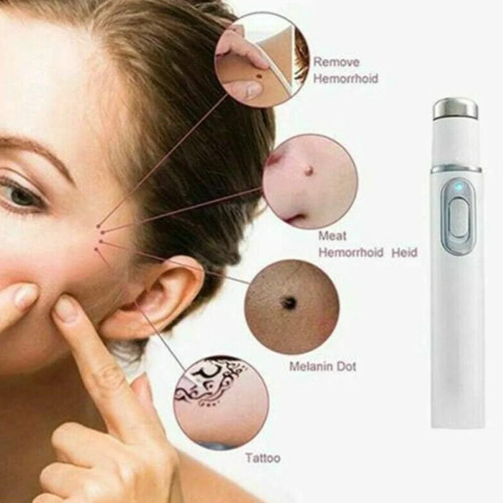Penna Laser per Terapia a Luce Blu per vene varicose, Antirughe e Acne