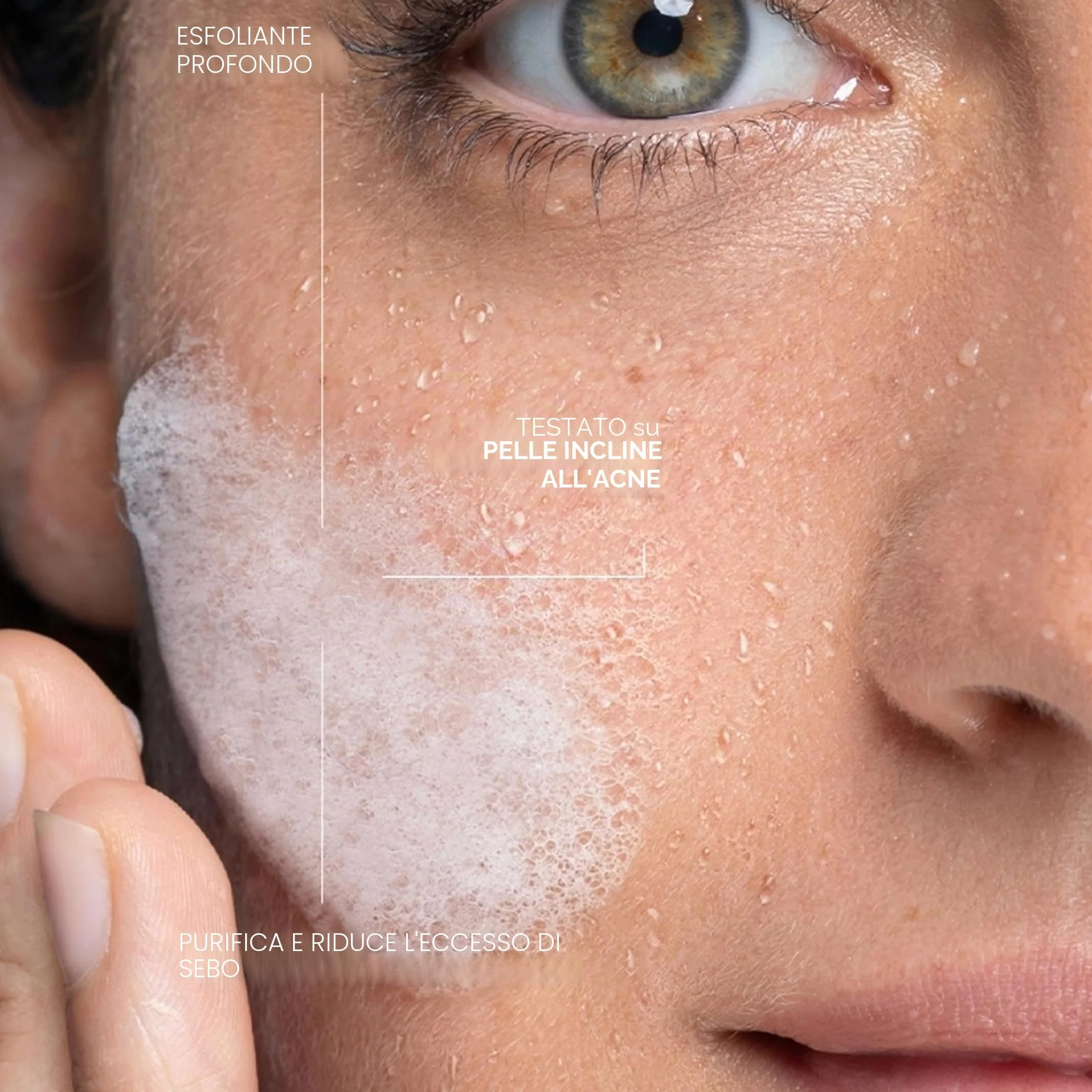 La Roche Posay Effaclar, Gel Purificante Micro-Peeling, Per Pelli Grasse a Tendenza Acneica, Azione Detergente, Pelle Levigata, Rimuove Sebo e Impurità, Con Acido Salicilico, LHA e Zinco, 200 ml