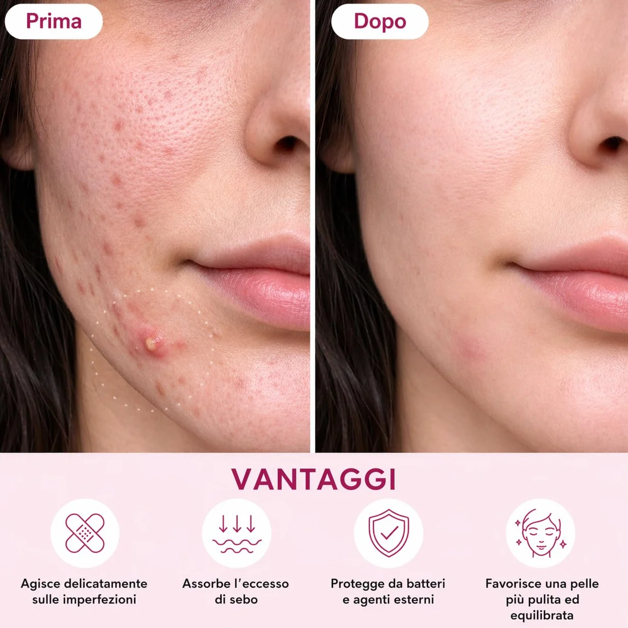 Enida – 96 patch anti-brufoli invisibili | 3 misure | azione mirata in una notte | patch idrocolloidi per acne | Cura viso discreta per adolescenti e adulti, senza profumo + eBook di bellezza in