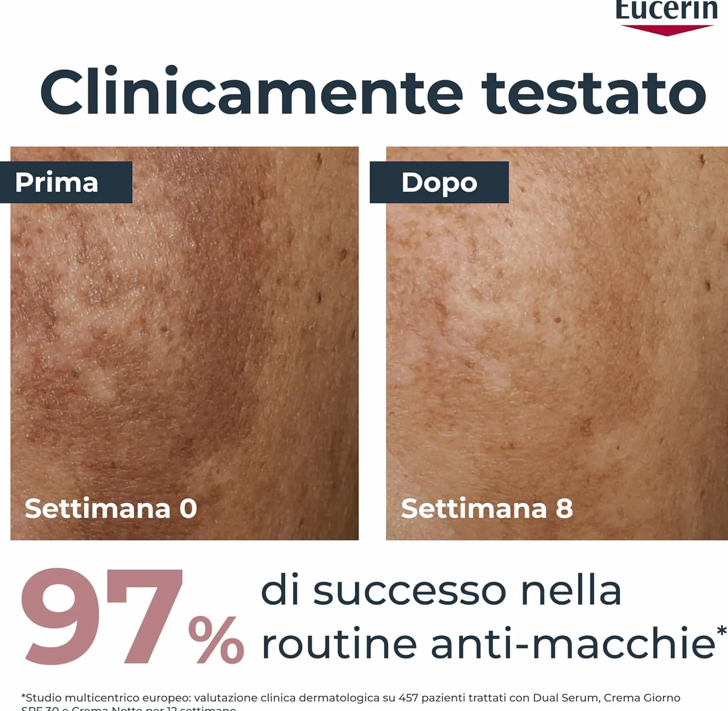 Eucerin Anti-Pigment Crema Viso Giorno SPF30 50 ml, Crema antimacchie viso per una pelle più uniforme e luminosa, Formula arricchita con SPF 30, filtri UV e Thiamidol per tutti i tipi di pelle