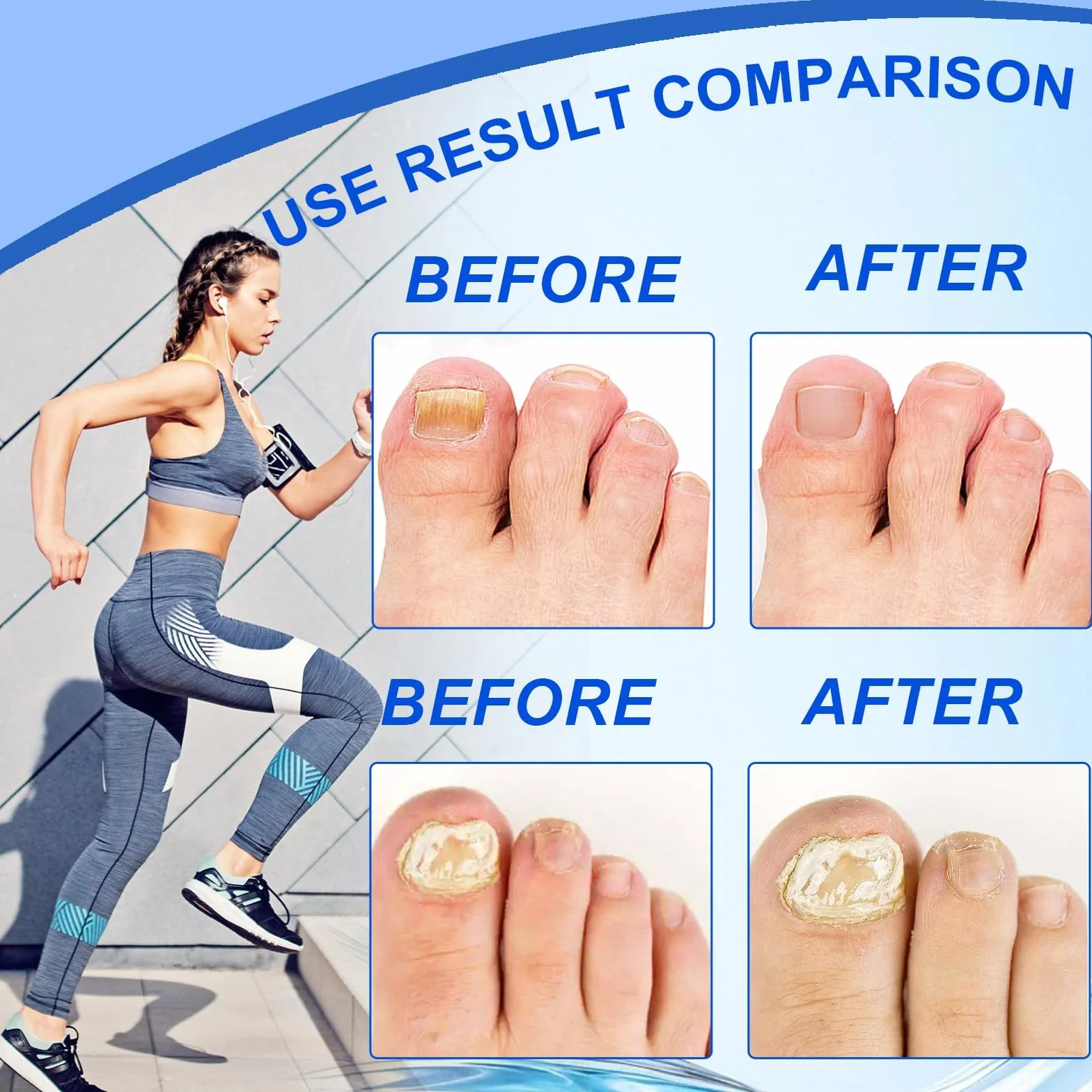 20g Crema per Riparazione Unghie,Cura delle Unghie,Proteggi e Rigenerate per Piede Nail,Ripristina le Scolorite,Nutre e Lenisce Le Unghies Donne e Uomini